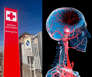 Immagine descrittiva ictus ischemico