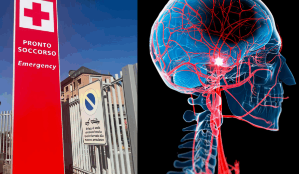 Immagine descrittiva ictus ischemico